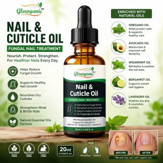 Nail Fungus Treatment Oil 30ml for fungal, yellow, thick, and damaged nails